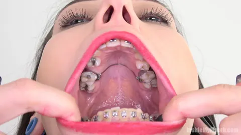 Brunette with Braces Opens Wide for the Camera – photo 12 of 15