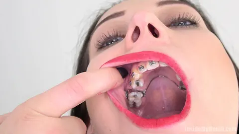 Brunette with Braces Opens Wide for the Camera – photo 11 of 15
