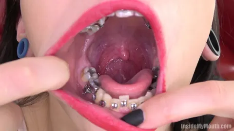 Brunette with Braces Opens Wide for the Camera – photo 3 of 15